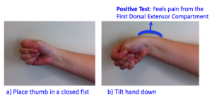 Finkelstein test